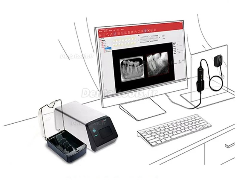 Handy HDS-500 Scanner de plaque de phosphore Scanner de Plaques PSP Numérique Dentaire